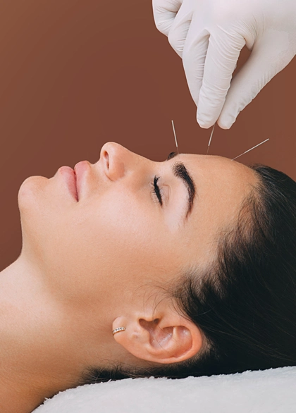 Acupuncture précise